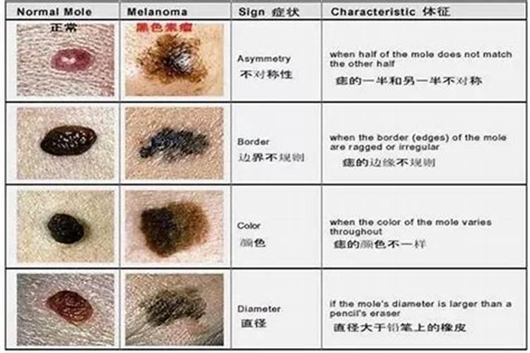 童子命胳膊上有红痣吗