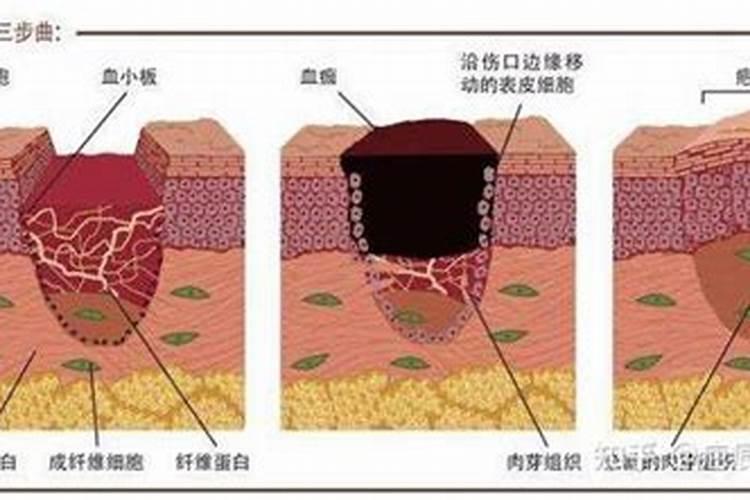 童子命有疤就不会带走吗