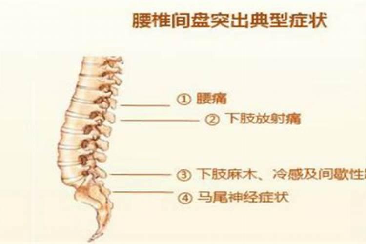 腰间盘突出风水