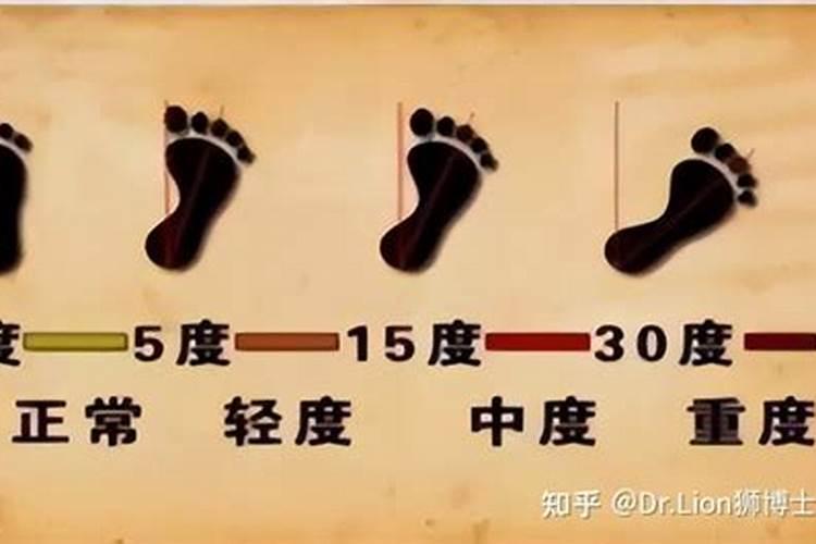 走八字步的人命运好吗