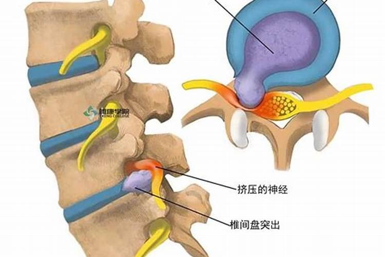 家中腰椎病风水