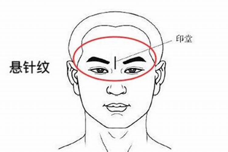 印堂有疤婚姻不顺怎么化解呢